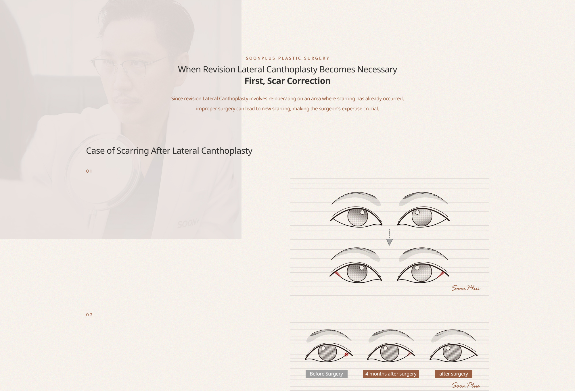 첫번째, 흉터 교정