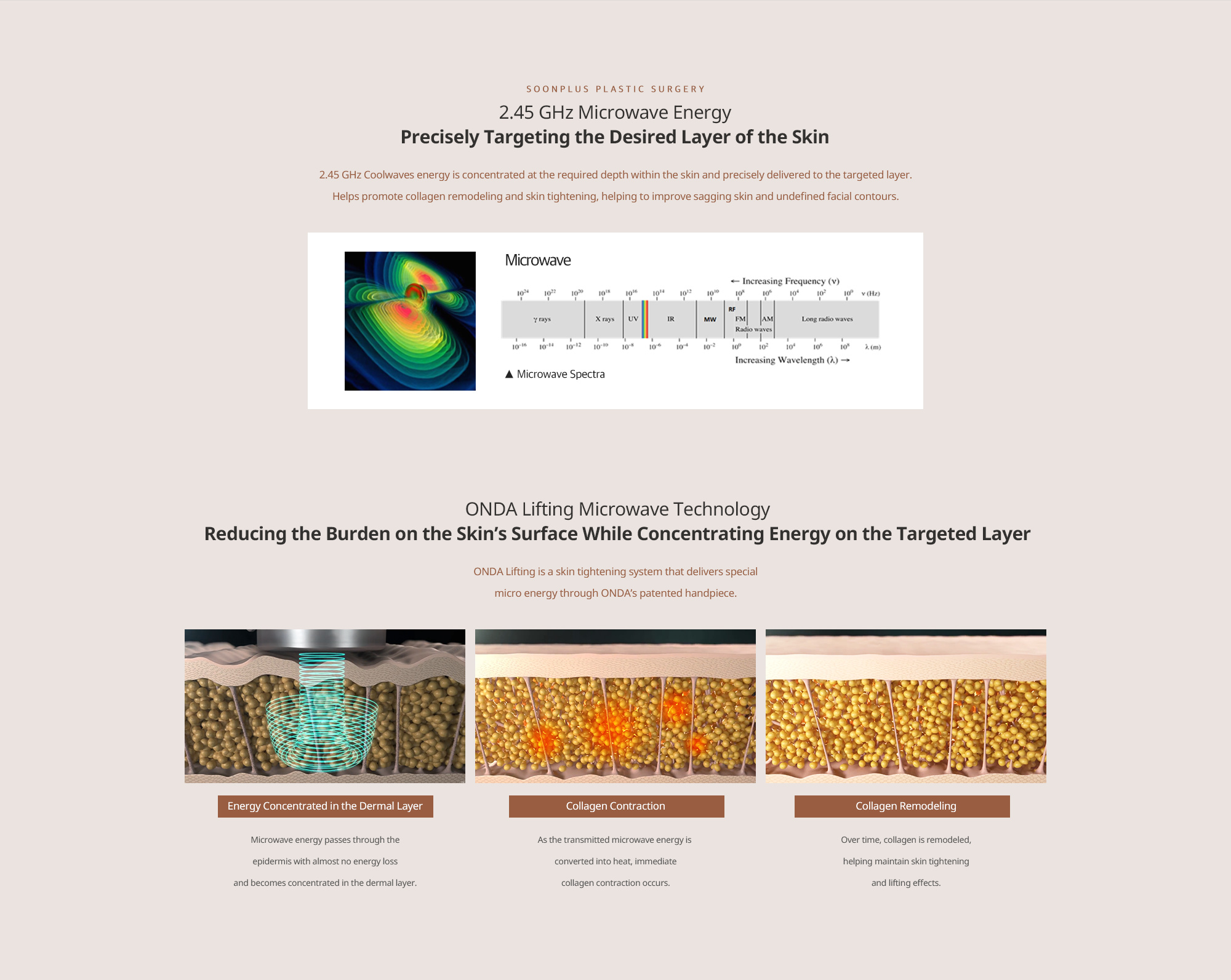 2.45 GHz microwave energy precisely targets the desired layer of the skin. ONDA microwave technology: energy concentrated in the dermal layer, collagen contraction and remodeling.