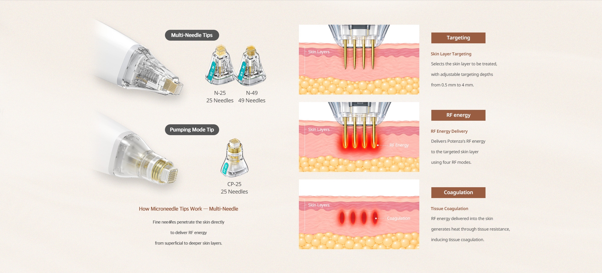 Potenza invasive multi-needle tips: microneedles and RF energy for targeting and coagulation.